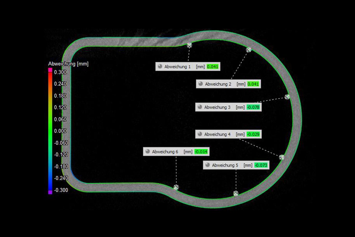 Messauswertung eines CT-Scans